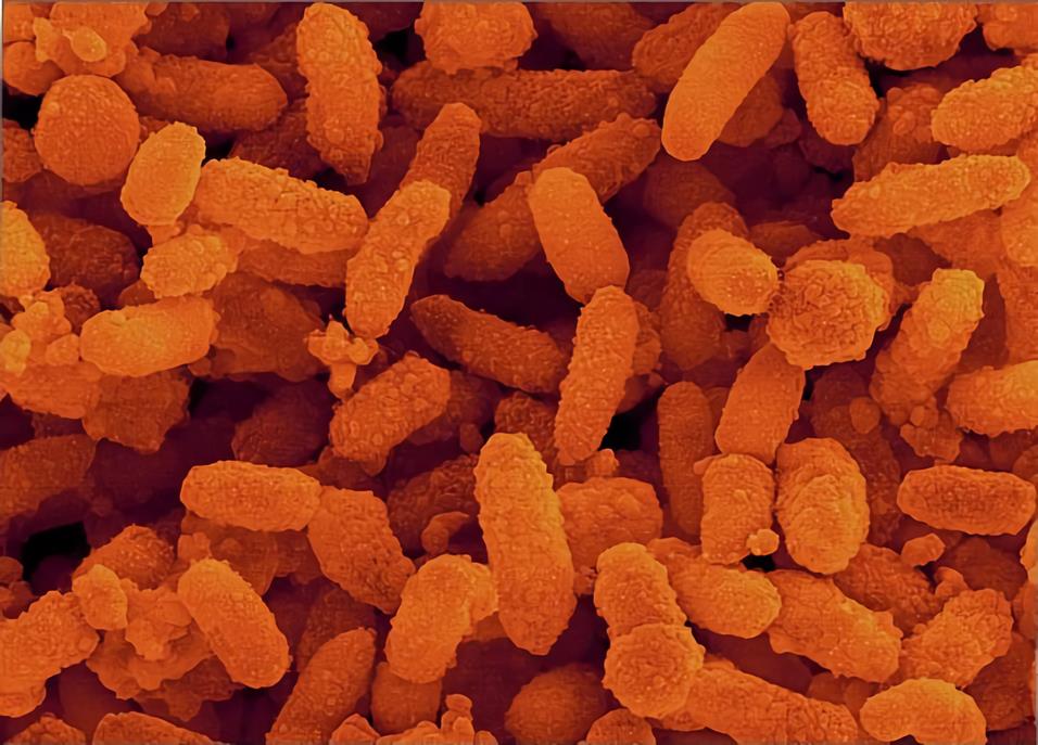 Aeromonas-hydrophila-Vaccines-1